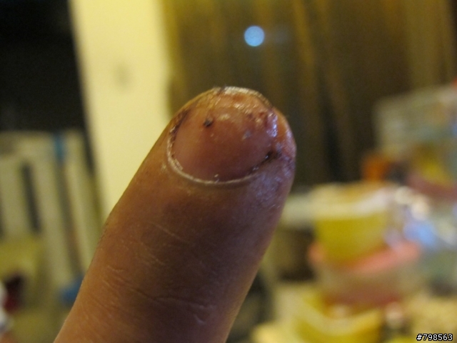 騎車釐田後的好東西...XD  (內有血腥照片...不喜勿入Orz)