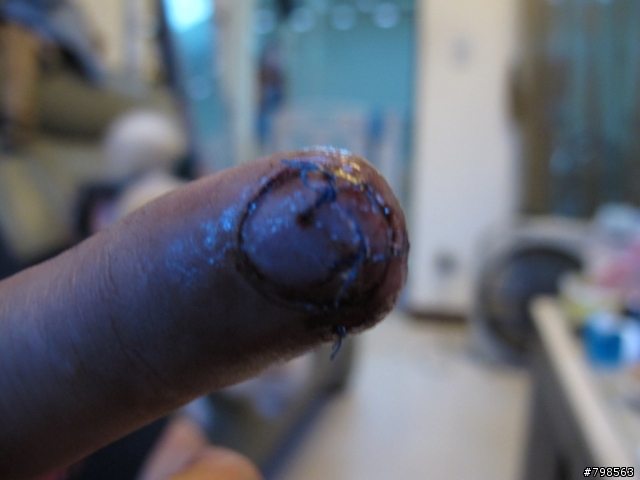 騎車釐田後的好東西...XD  (內有血腥照片...不喜勿入Orz)