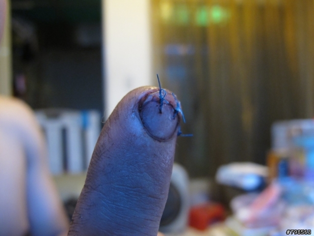 騎車釐田後的好東西...XD  (內有血腥照片...不喜勿入Orz)