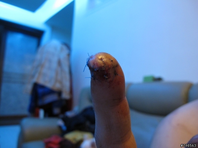 騎車釐田後的好東西...XD  (內有血腥照片...不喜勿入Orz)