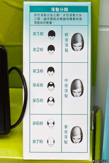 實探！免費頭皮檢測活動 鑑定你的落髮狀況