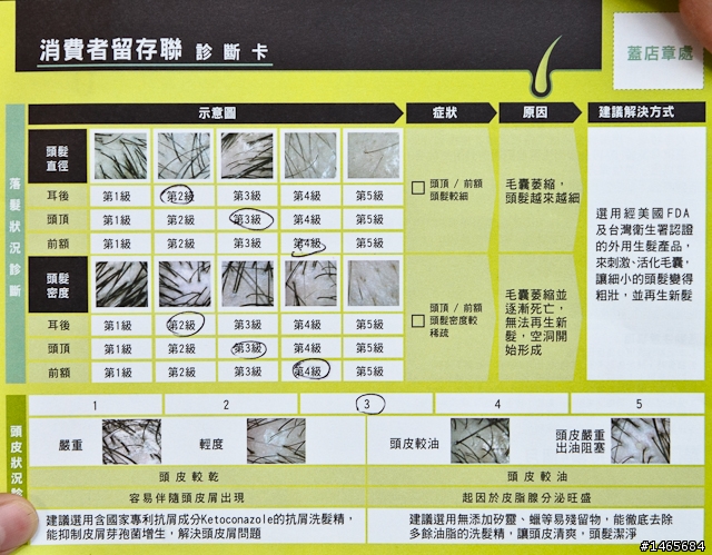 實探！免費頭皮檢測活動 鑑定你的落髮狀況