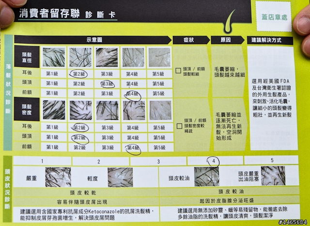 實探！免費頭皮檢測活動 鑑定你的落髮狀況