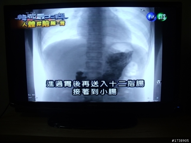 集品6247簡單開箱~~
