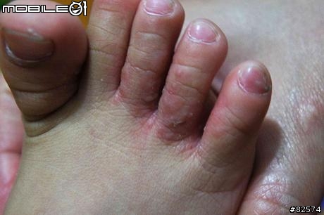 2歲小朋友的腳指頭@@  難道... [以更新]