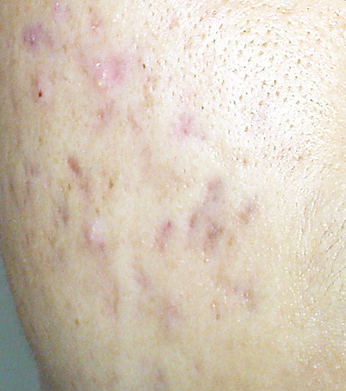 請問有關男性臉部保養