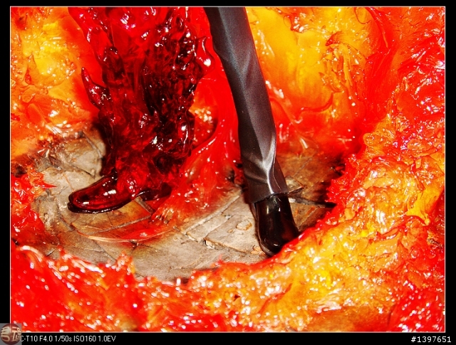 火拳艾斯和香吉士的火場景(圖片更新)