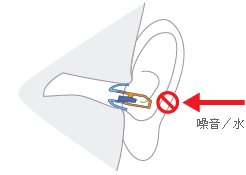 請問我的XBA-30這樣有組裝問題嗎 ?