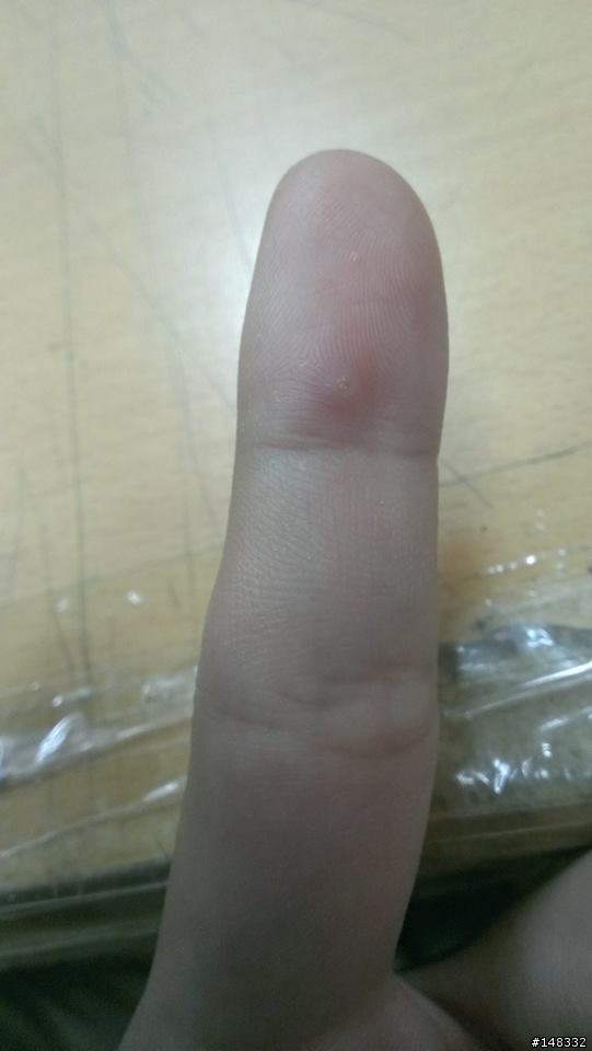 手指不知道長什麼