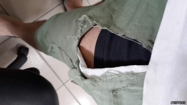 對方開車門 ~ 而我摔倒沒有碰撞到他的車子 ~ 所以對方不需要負任何責任 .....