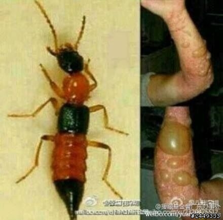 天阿發現終極毒蟲