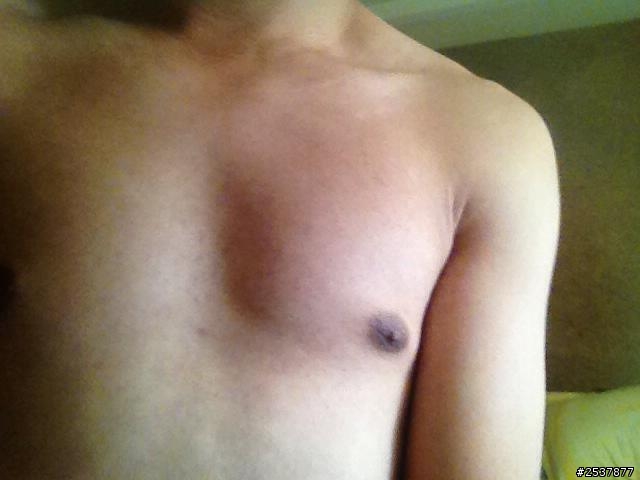 請問一下...胸部外側下方乳頭部分外擴要怎麼救阿@@? (有圖)