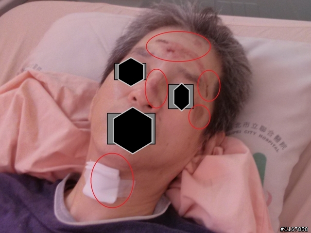 騎車請注意安全, 在此徵求目擊者, 幫幫我的父親~