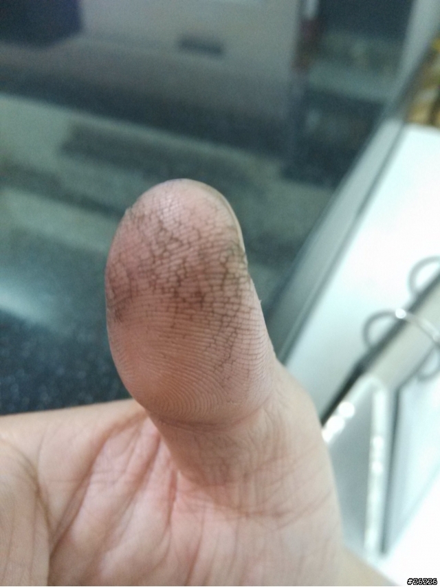 富貴手嗎？手指好痛啊！