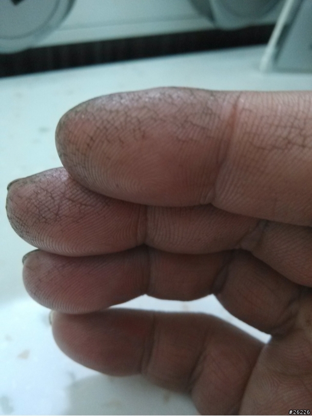 富貴手嗎？手指好痛啊！