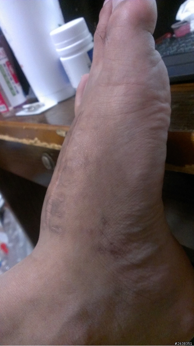 想請問一下這樣子當兵OK嗎?