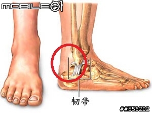 關於後腳跟痛。