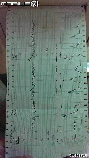 要生了沒???分享一下我家水水的胎心音宮縮監測圖^^