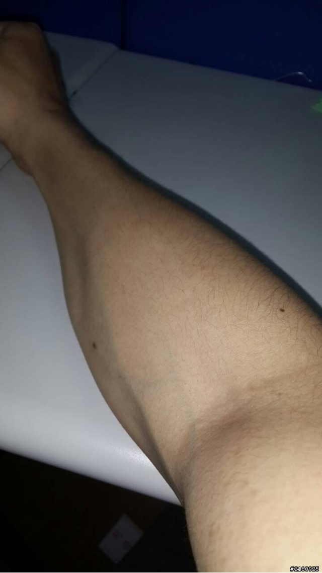 手上的肌肉要怎麼減呢?