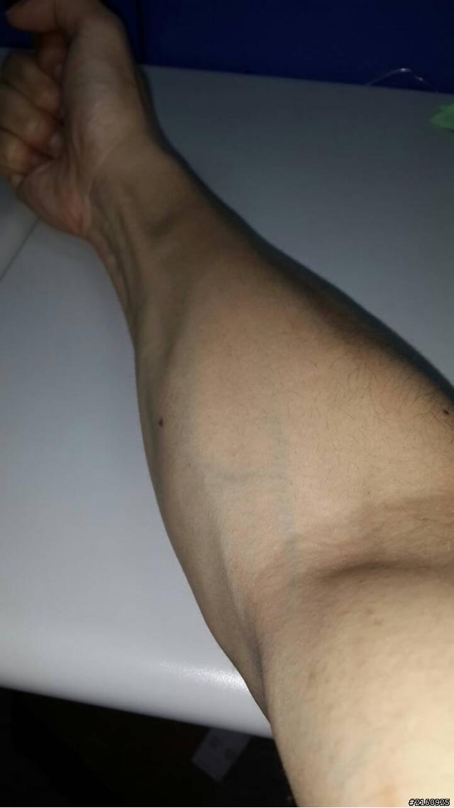手上的肌肉要怎麼減呢?