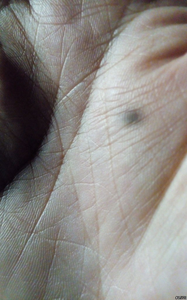 酷派9976A 相機有黑點