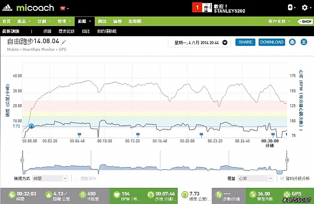 慢跑時,腳底內側疼痛
