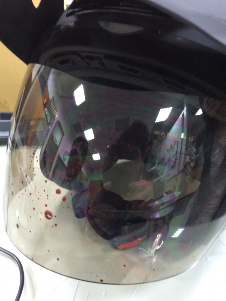 行車糾紛處理請教(內有些許血腥圖片請慎入)