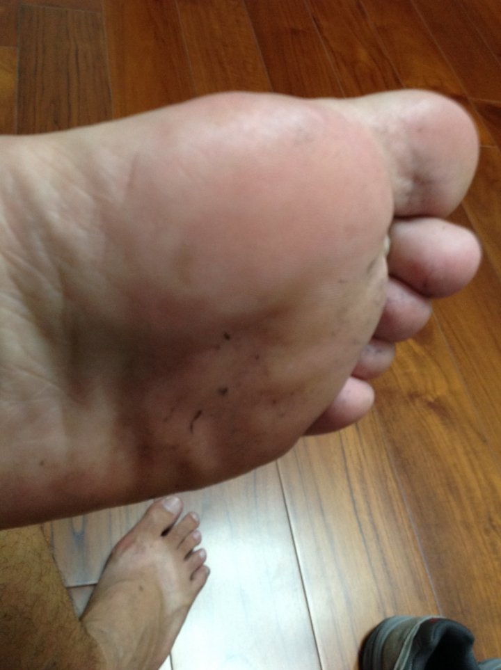New Balance 運動襪脫毛