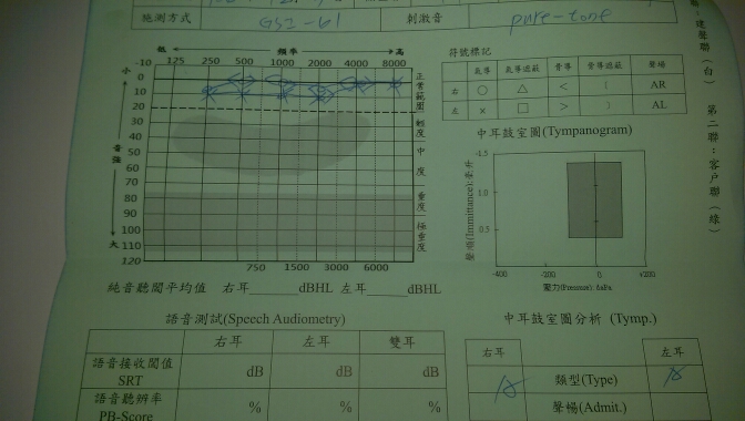 如何看聽力評估表呢