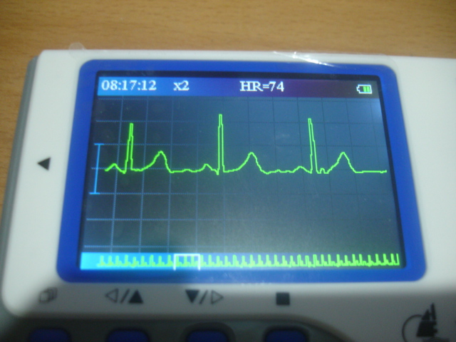 心律儀 pc-80b 使用心得：無法在運動中準確紀錄