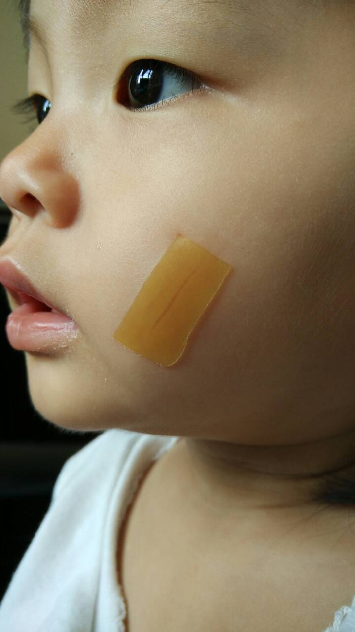 臉部割傷要擦什麼藥修復?