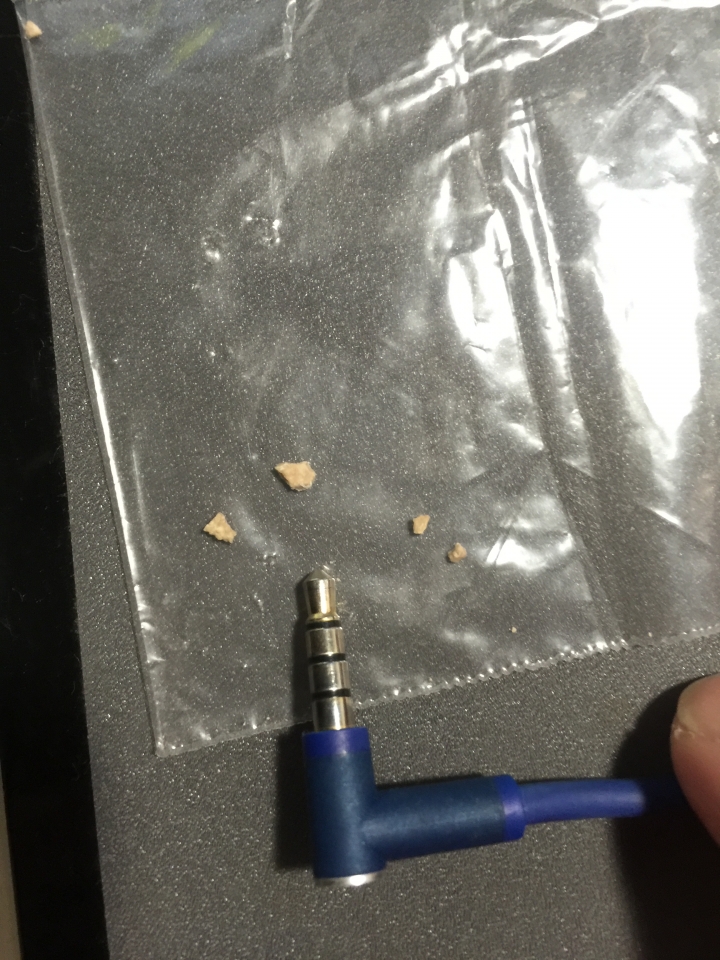 非常難纏的腎臟結石問題..(內有取出石頭，不喜勿進）