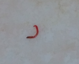 有誰看過這種蟲嗎(腸胃寄生蟲?還是其他的?)