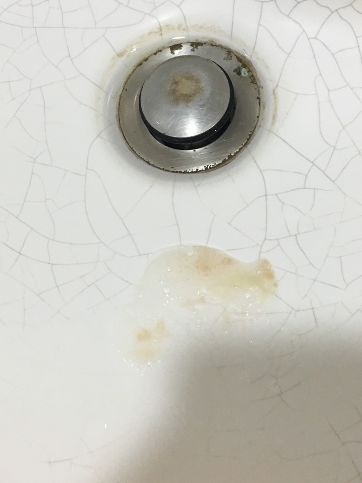 痰中有血....找不到原因 11/11更新.... 求解