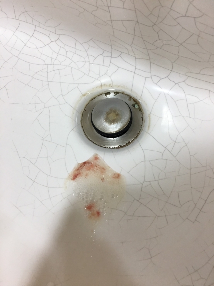 痰中有血....找不到原因 11/11更新.... 求解