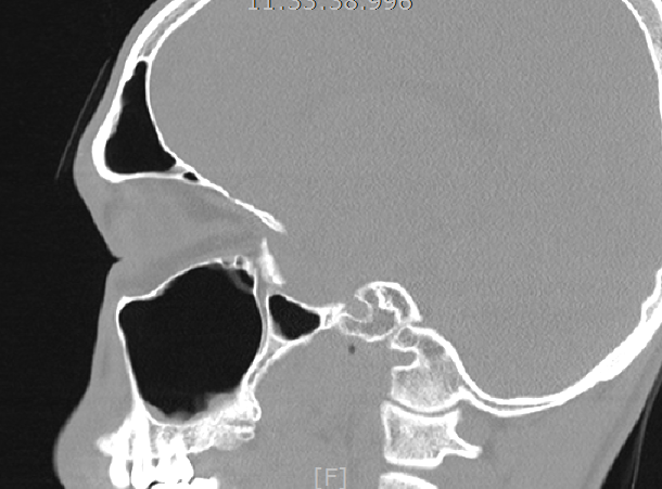 痰中有血....找不到原因 11/11更新.... 求解
