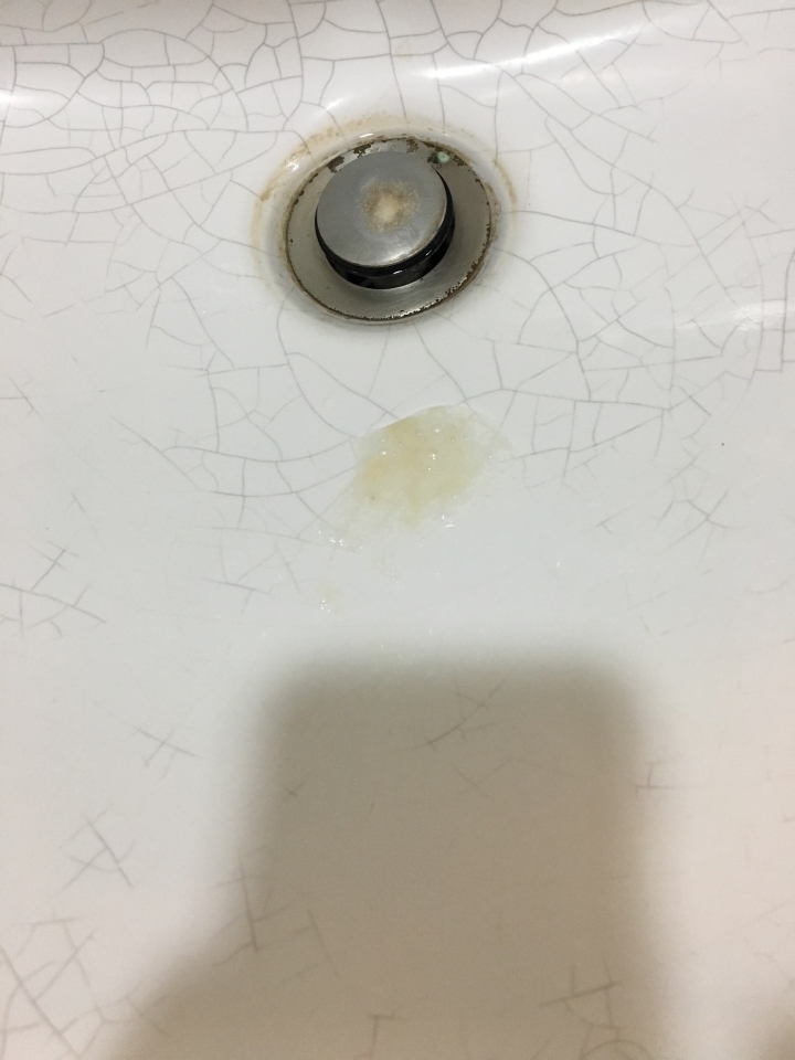 痰中有血....找不到原因 11/11更新.... 求解