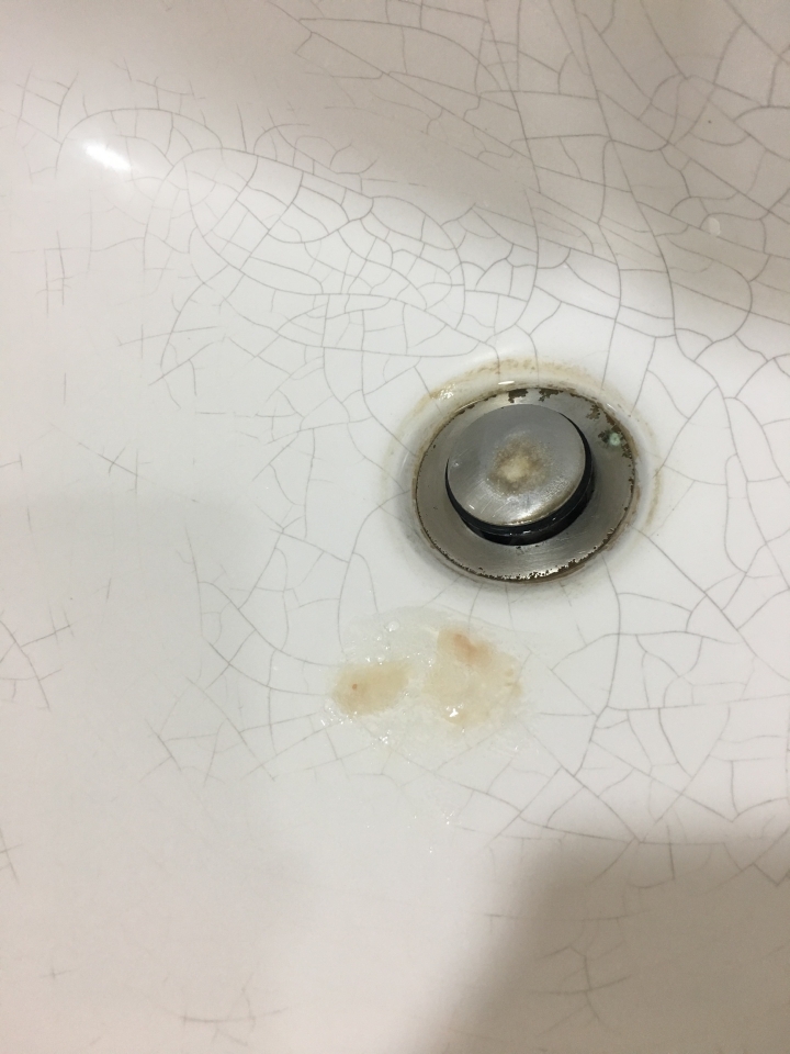 痰中有血....找不到原因 11/11更新.... 求解