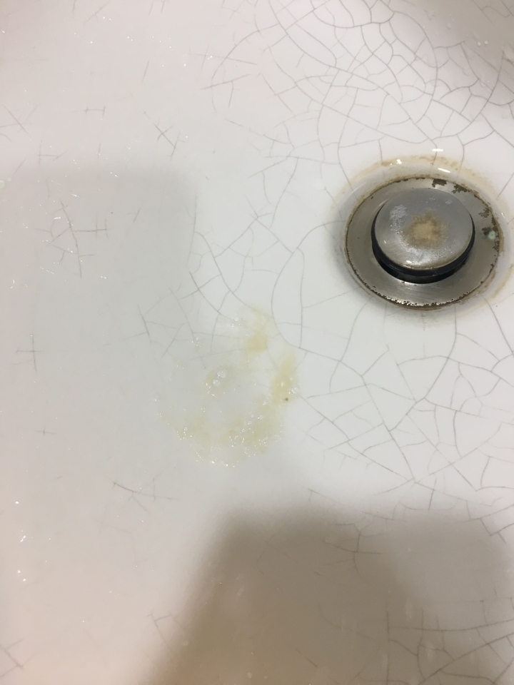 痰中有血....找不到原因 11/11更新.... 求解