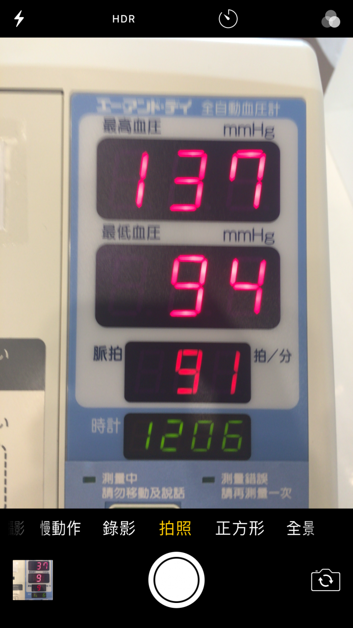 iphone 6+、iphone 7 拍攝的照片有異常