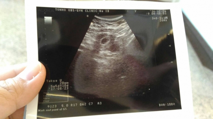 新手媽咪請求問題~