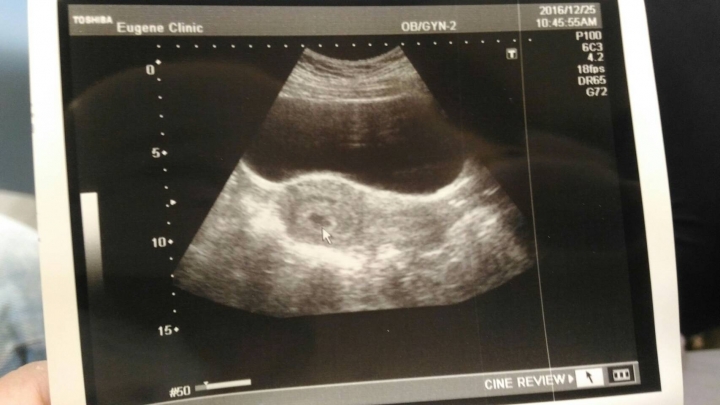 新手媽咪請求問題~