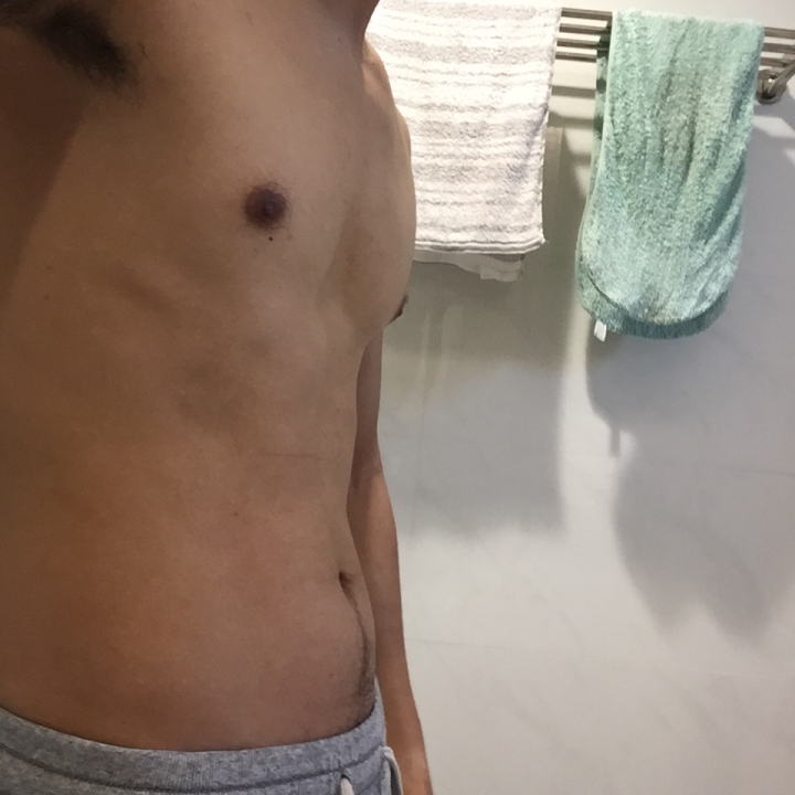 增肌&減脂方向請益 (附訓練課表,飲食,傷眼圖)