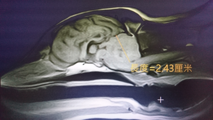 狗狗有腦瘤該手術嗎?---4/6謝謝各位4/6狗狗走了
