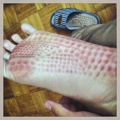 18禁無膽勿入～測試自己有沒有密集恐懼症？