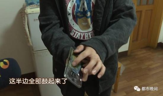 [新聞]驚壞了！湖南小夥三星S7手機手中爆炸 冒出滾滾白煙