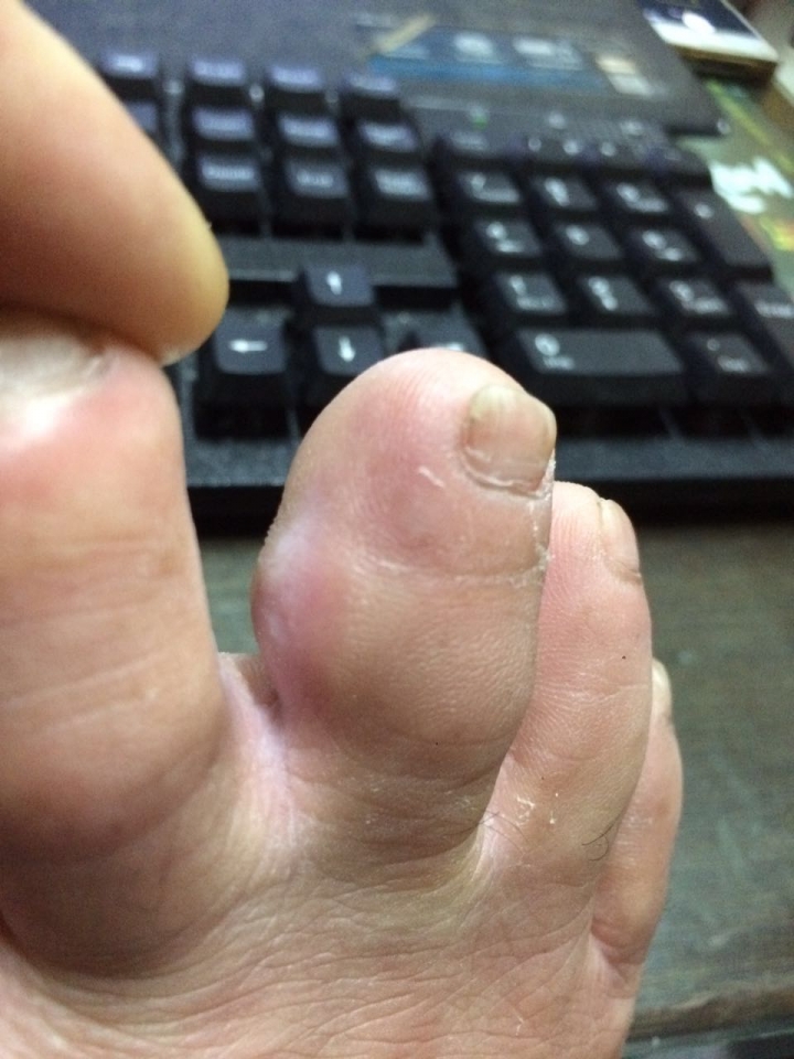 請問小弟這要掛什麼科?   什麼病?