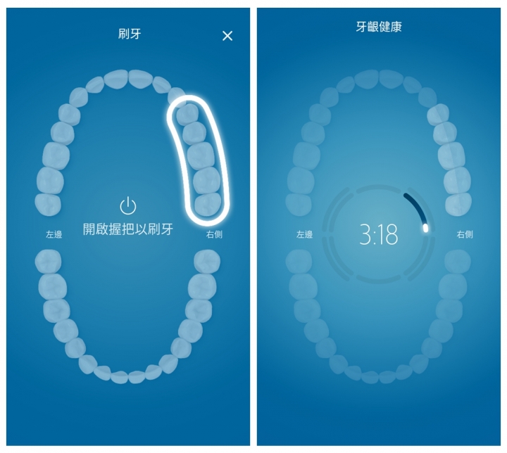 【試用分享】 飛利浦鑽石靚白智能音波震動牙刷