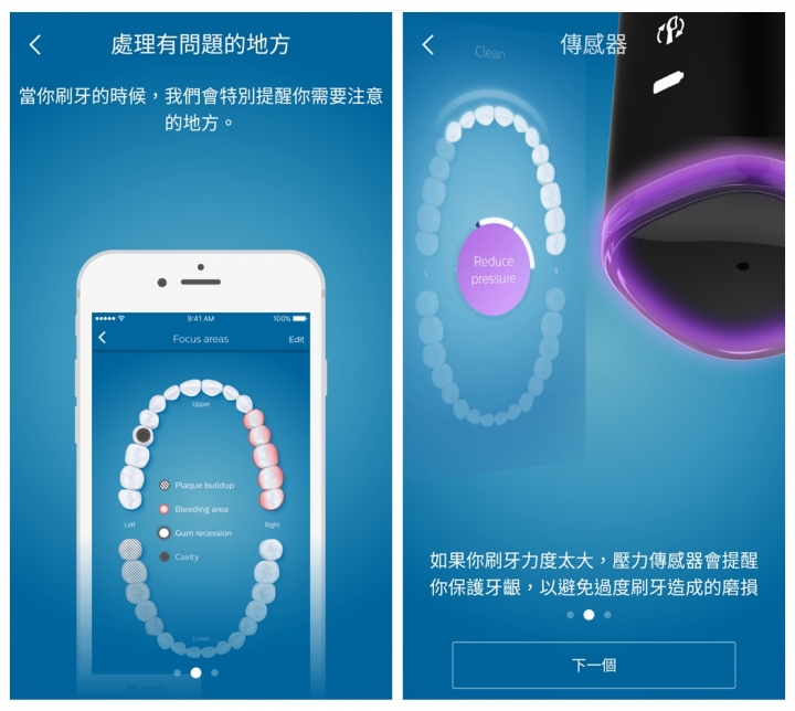 【試用分享】 飛利浦鑽石靚白智能音波震動牙刷