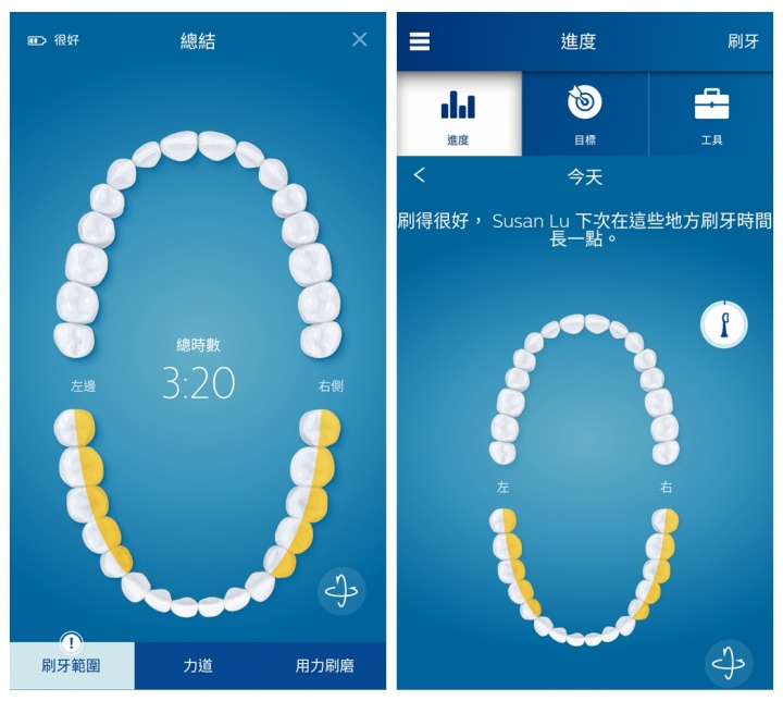 【試用分享】 飛利浦鑽石靚白智能音波震動牙刷